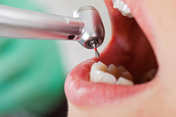 Best Emergency Treatment for Dental Infections or Abscesses in Tangelo Park, FL